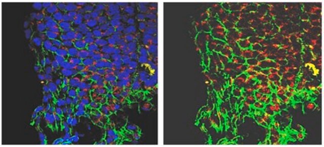 Anti-Dynamin related protein 1 (Drp1) Antibody from rabbit, purified by affinity chromatography