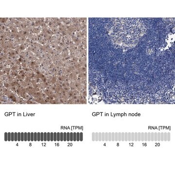 Anti-GPT antibody produced in rabbit Prestige Antibodies&#174; Powered by Atlas Antibodies, affinity isolated antibody, buffered aqueous glycerol solution, ab1