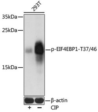 Przeciwciało anty-fosfo-EIF4EBP1-T37/46produkowane u królików