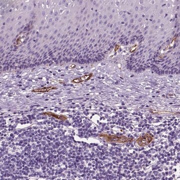 抗VWF ウサギ宿主抗体 Ab1, Prestige Antibodies&#174; Powered by Atlas Antibodies, affinity isolated antibody, buffered aqueous glycerol solution