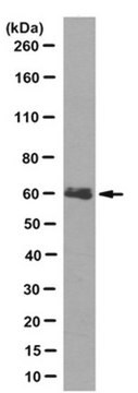 Anti-hIAP-1/BIRC3 Antibody, clone 11D12.1 clone 11D12.1, from mouse