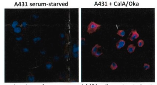 抗-磷酸苏氨酸抗体，克隆RM102 clone RM102, from rabbit, purified by affinity chromatography