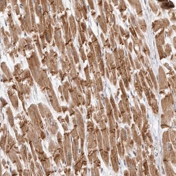 Anti-TMEM65 antibody produced in rabbit Prestige Antibodies&#174; Powered by Atlas Antibodies, affinity isolated antibody, buffered aqueous glycerol solution