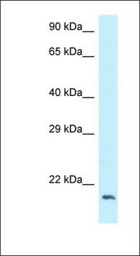 Anti-DCTN3 antibody produced in rabbit affinity isolated antibody