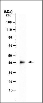 Anti-MBNL2 Antibody, clone MB2a(3B4) clone MB2a(3B4), 1&#160;mg/mL, from mouse