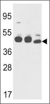 ANTI-CYK18(C-TERMINAL) antibody produced in rabbit purified immunoglobulin, buffered aqueous solution