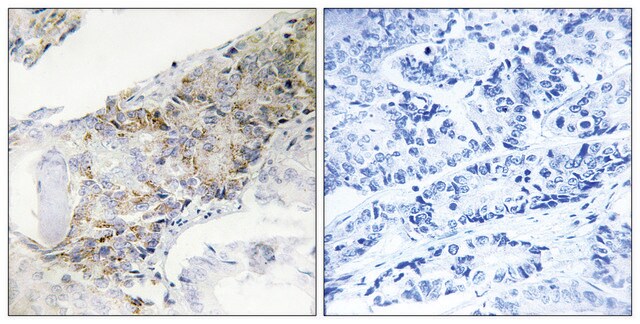 Anti-COX5B antibody produced in rabbit affinity isolated antibody