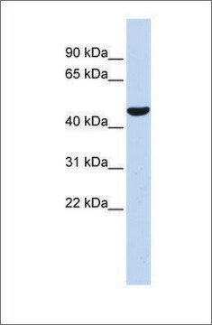 抗PTGIS抗体 ウサギ宿主抗体 affinity isolated antibody