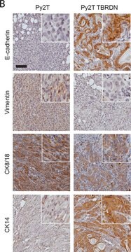 モノクロナール抗ビメンチン マウス宿主抗体 clone LN-6, ascites fluid