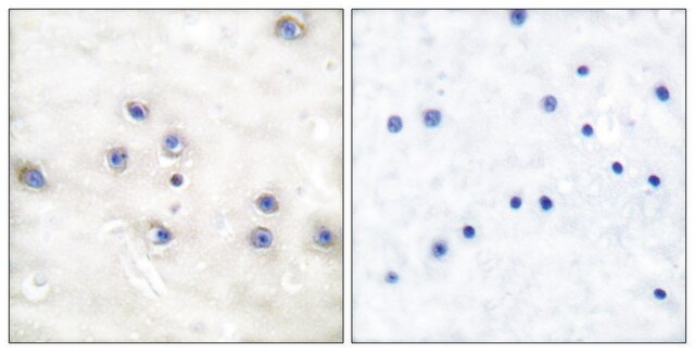 Anti-COT antibody produced in rabbit affinity isolated antibody