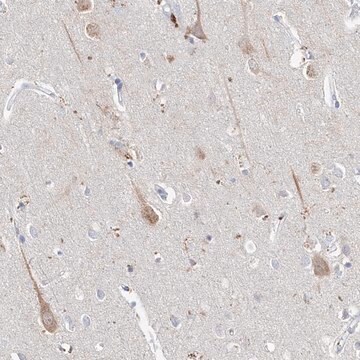 Anti-ASNS antibody produced in rabbit Prestige Antibodies&#174; Powered by Atlas Antibodies, affinity isolated antibody, buffered aqueous glycerol solution