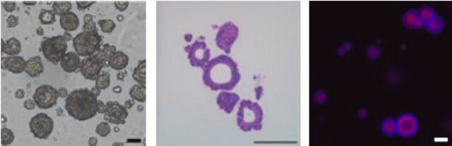 Humane 3dGRO&#174;-CRC-Organoide (ISO38)