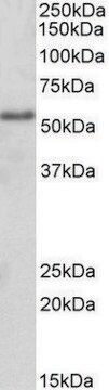 Anti-FOXC1 antibody produced in goat affinity isolated antibody, buffered aqueous solution