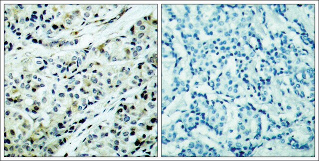 Anti-phospho-HDAC5 (pSer498) antibody produced in rabbit affinity isolated antibody