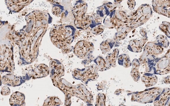 抗YAP1抗体 クローン4F22 ZooMAb&#174;ウサギモノクローナル recombinant, expressed in HEK 293 cells