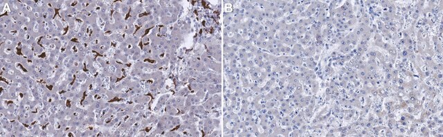 Anti-CD163 Antibody, clone MAC2-158