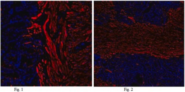 Anti-Calponin-1 Antibody from rabbit, purified by affinity chromatography