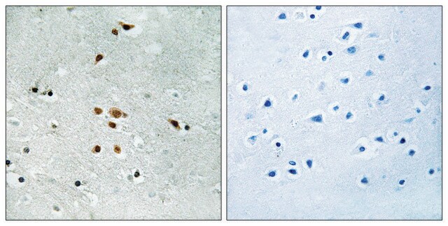 Anti-phospho-FER (pTyr402) antibody produced in rabbit affinity isolated antibody