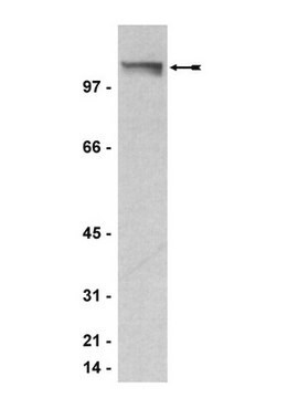 Anticorps anti-PML, clone 36,1-104 clone 36.1-104, Upstate&#174;, from mouse