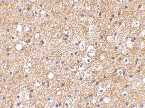 Anti-IPR1 (ab1) antibody produced in rabbit affinity isolated antibody, buffered aqueous solution