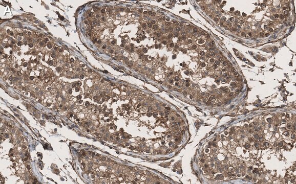 Anti-KLF5 Antibody, clone 1J12 ZooMAb&#174; Rabbit Monoclonal recombinant, expressed in HEK 293 cells