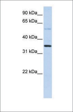 抗ANKRD9抗体 ウサギ宿主抗体 affinity isolated antibody