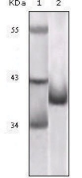 抗CDKN2A单抗 小鼠抗 clone 1E12E10, ascites fluid