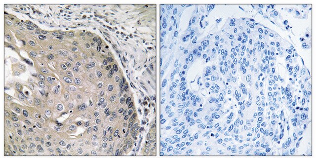 Anti-AOX1 antibody produced in rabbit affinity isolated antibody