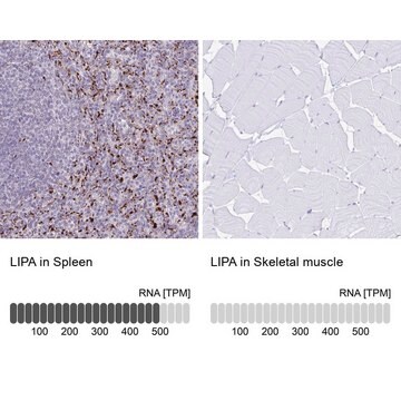 Anti-LIPA antibody produced in rabbit Prestige Antibodies&#174; Powered by Atlas Antibodies, affinity isolated antibody, buffered aqueous glycerol solution