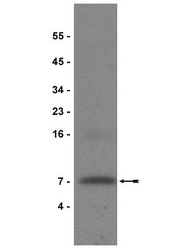 Anticorpo anti-IGF-I, clone Sm1.2 clone Sm1.2, Upstate&#174;, from mouse