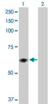 Anti-PDIA5 antibody produced in rabbit purified immunoglobulin, buffered aqueous solution