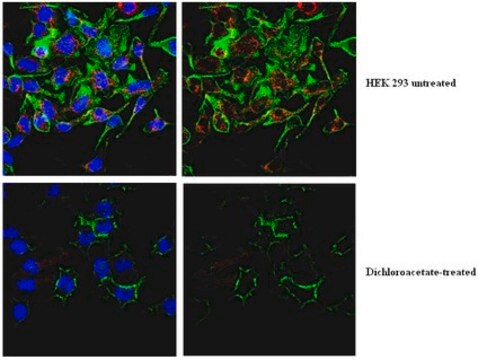 Anti-phospho PDHE1-A type I (Ser300) Antibody from rabbit, purified by affinity chromatography