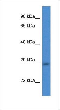 Anti-TMEM33 antibody produced in rabbit affinity isolated antibody