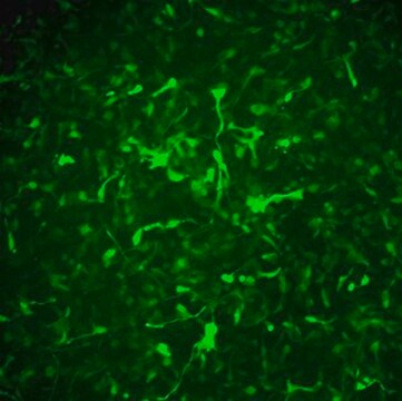 Alzheimer&#8217;s In A Dish&#8482; APPSL-GFP Lentivirus