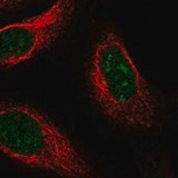 Anti-UCK1 antibody produced in rabbit Prestige Antibodies&#174; Powered by Atlas Antibodies, affinity isolated antibody, buffered aqueous glycerol solution