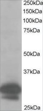 Anti-CAPZB antibody produced in goat affinity isolated antibody, buffered aqueous solution