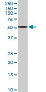 Anti-ALDH3A2 antibody produced in rabbit purified immunoglobulin, buffered aqueous solution