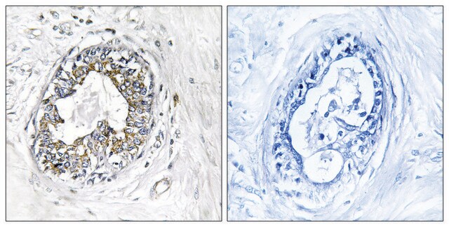 抗PAK1抗体 ウサギ宿主抗体 affinity isolated antibody