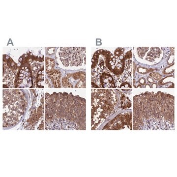 Anti-MKKS antibody produced in rabbit Prestige Antibodies&#174; Powered by Atlas Antibodies, affinity isolated antibody, buffered aqueous glycerol solution