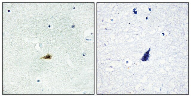 Anti-NCOR2 antibody produced in rabbit affinity isolated antibody