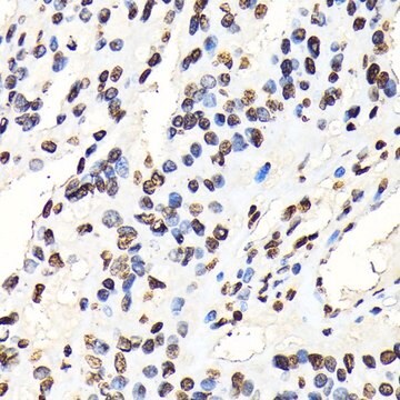 Anti-Phospho-STAT5A-Y694 antibody produced in rabbit