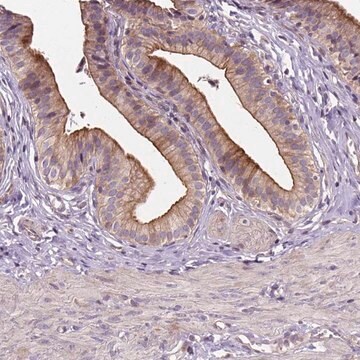 Anti-INPP5E antibody produced in rabbit Prestige Antibodies&#174; Powered by Atlas Antibodies, affinity isolated antibody, buffered aqueous glycerol solution