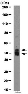 Anti-MMP-12 Antibody, NT (active) from rabbit, purified by affinity chromatography