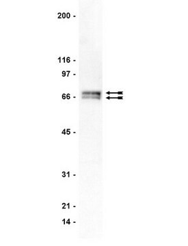 Anti-GRK 4-6 Antibody, clone A16/17 clone A16/17, Upstate&#174;, from mouse