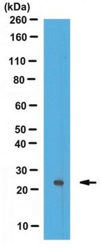 Anti-Monoubiquitin H2A-Antikörper (Lys119) from rabbit, purified by affinity chromatography