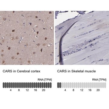 Anti-CARS antibody produced in rabbit Ab1, Prestige Antibodies&#174; Powered by Atlas Antibodies, affinity isolated antibody, buffered aqueous glycerol solution