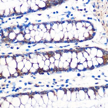 Anti-TFAM antibody produced in rabbit