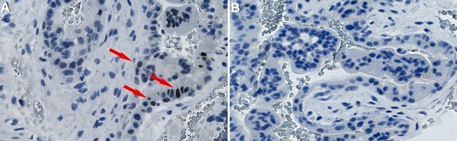 Anti-FosB Antibody, clone 3I8 ZooMAb&#174; Rabbit Monoclonal recombinant, expressed in HEK 293 cells