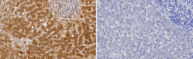 Anti-TRIM14 Antibody, clone 1J17 ZooMAb&#174; Rabbit Monoclonal recombinant, expressed in HEK 293 cells