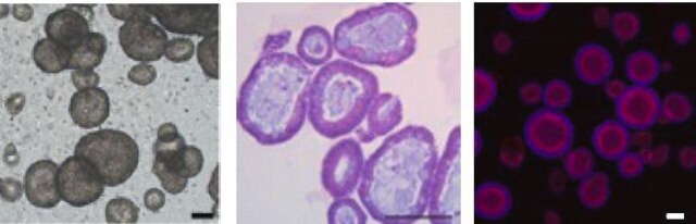 3dGRO&#174; Human CRC Organoids (ISO72)